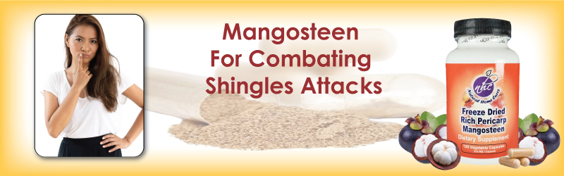 Shingles